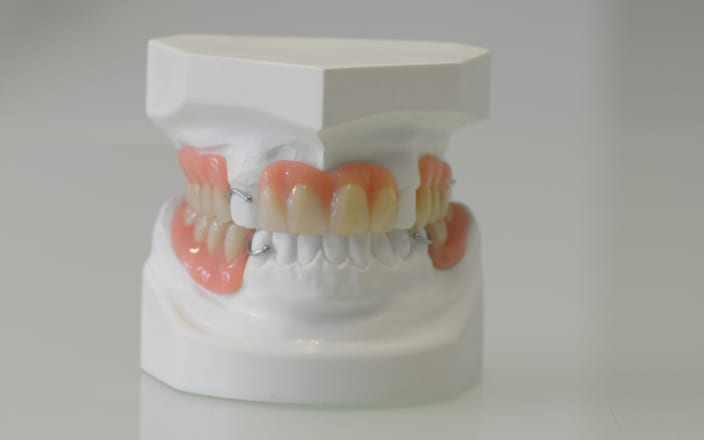 Dental implants sample