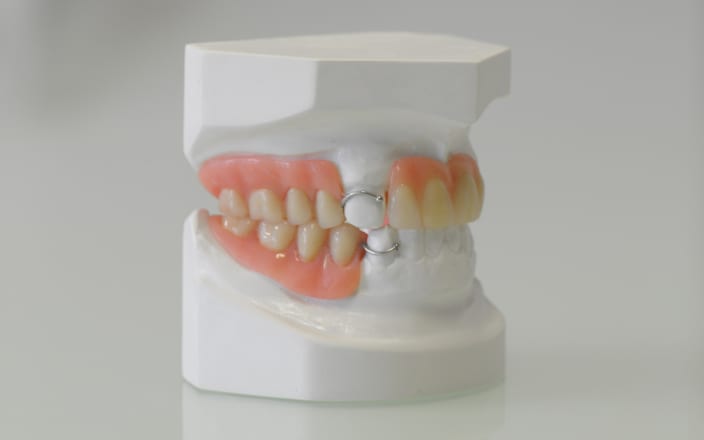 Dental Prothetic