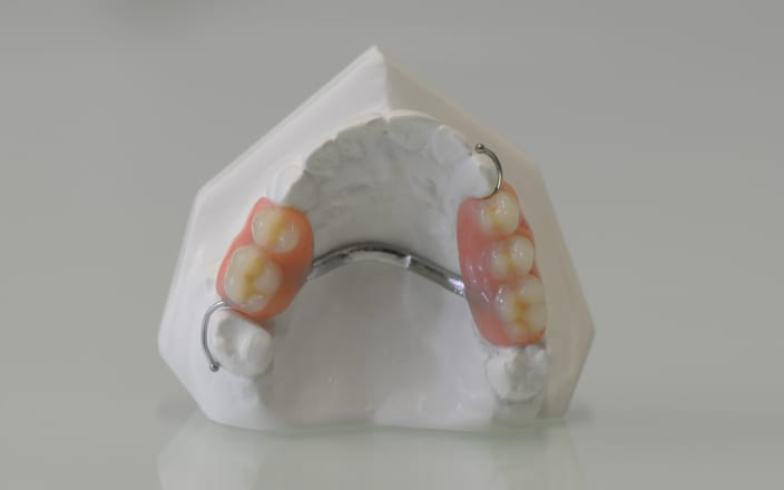 Dental Prothetic from Joseph Burke Lab