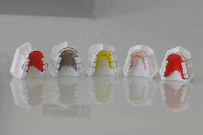 Retainers from an Orthodontist in Limerick