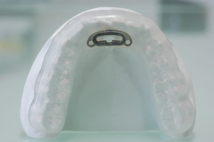 Sleep Apnoea dental implant
